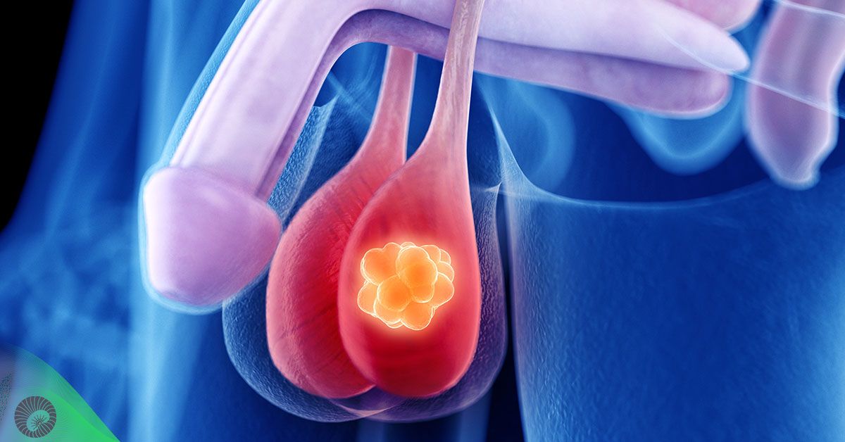 Cáncer de testículos-heriberto